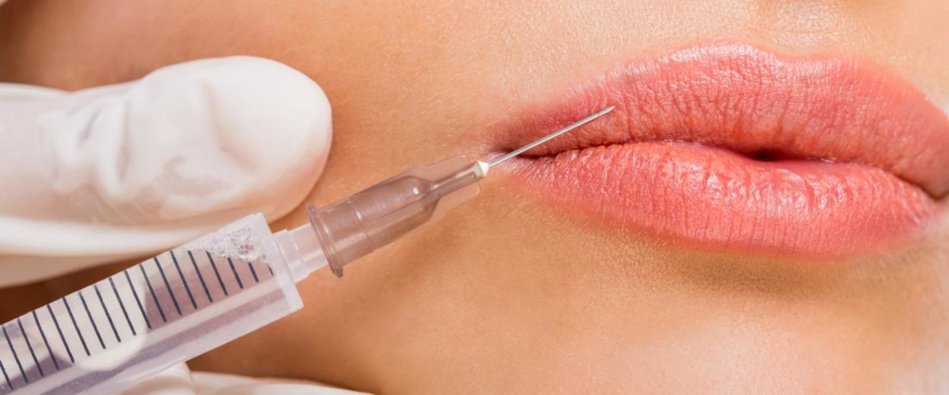 Whats Injectable Filler