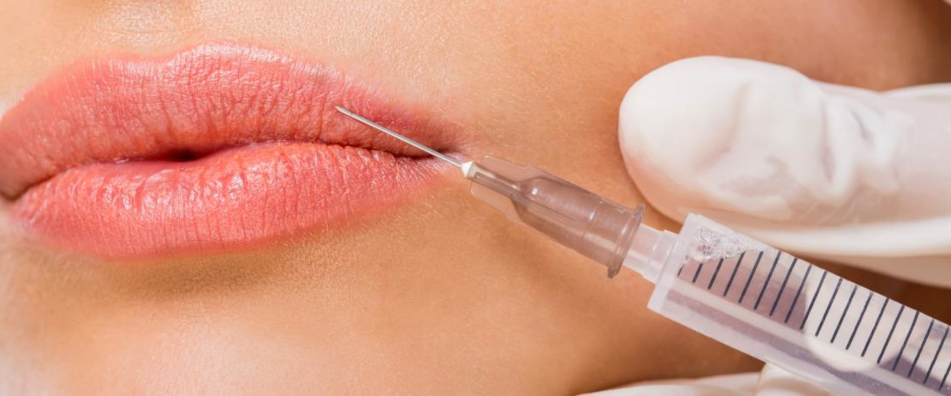How to Inject Dermal Fillers for Facial Rejuvenation