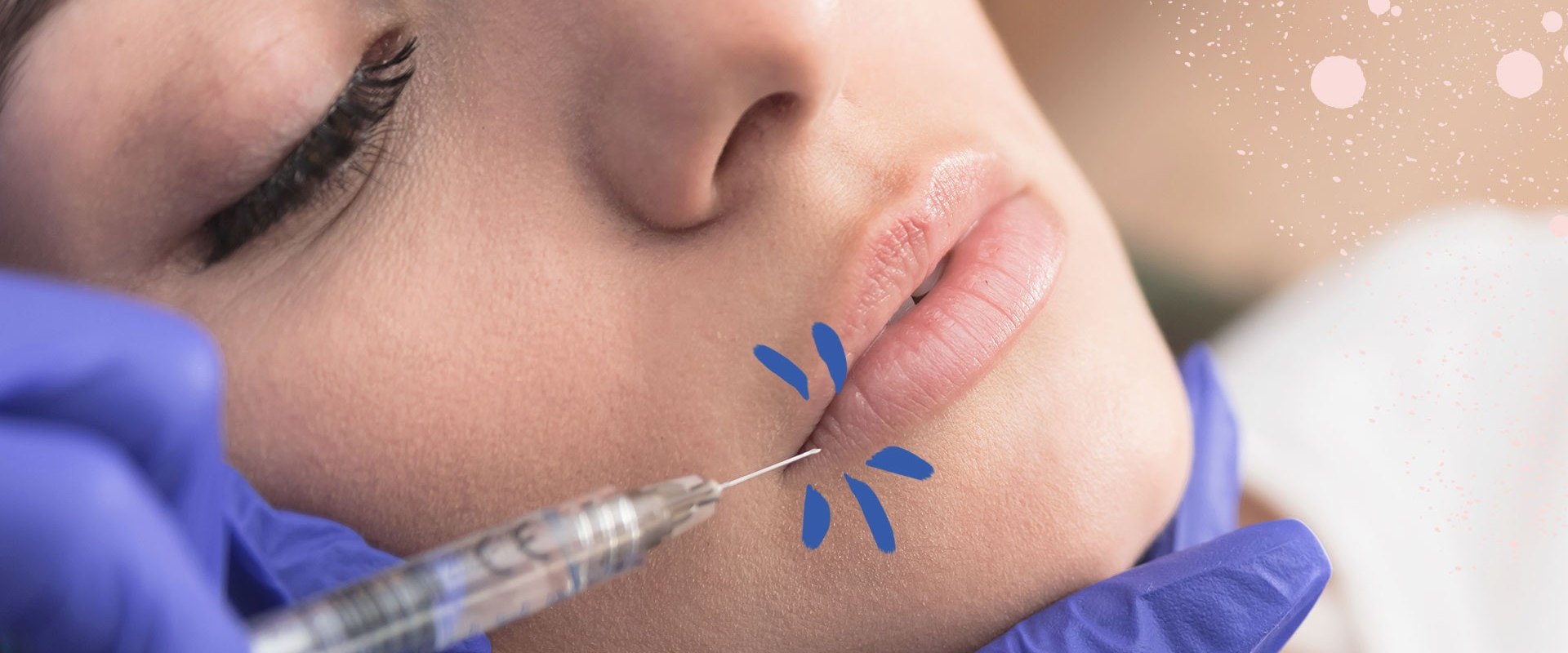 What are the Benefits of Dermal Fillers and Where are They Injected?