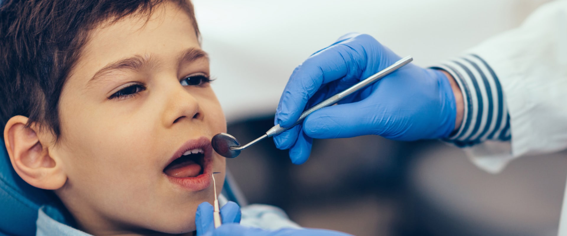 Can Dermal Fillers Last 5 Years?