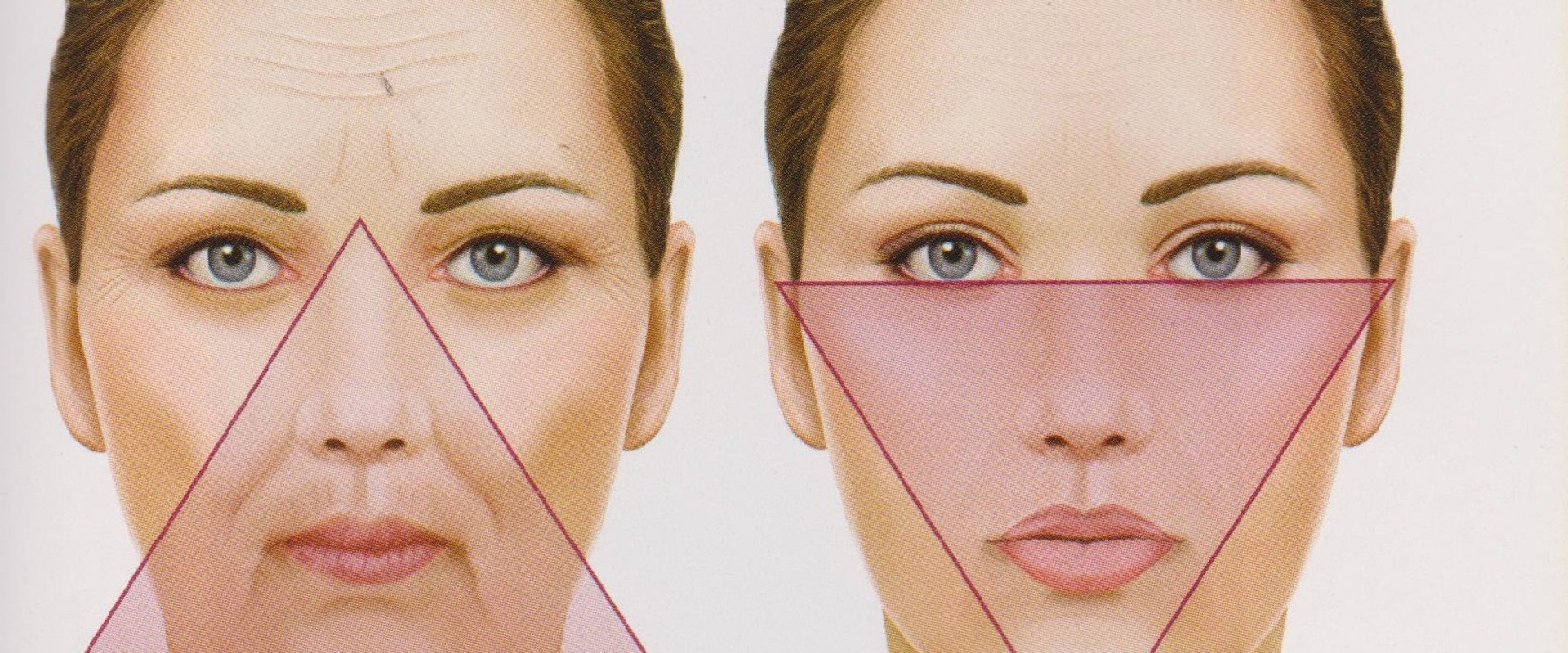 How Long Do Facial Fillers Last? A Comprehensive Guide