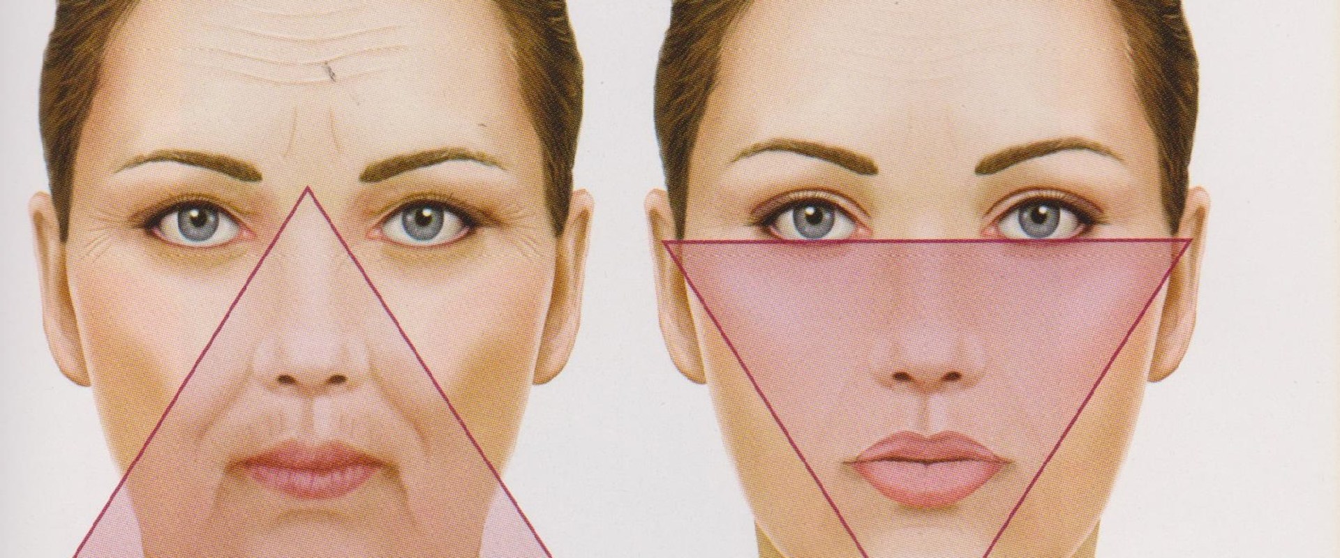 How Long Do Facial Fillers Last? A Comprehensive Guide