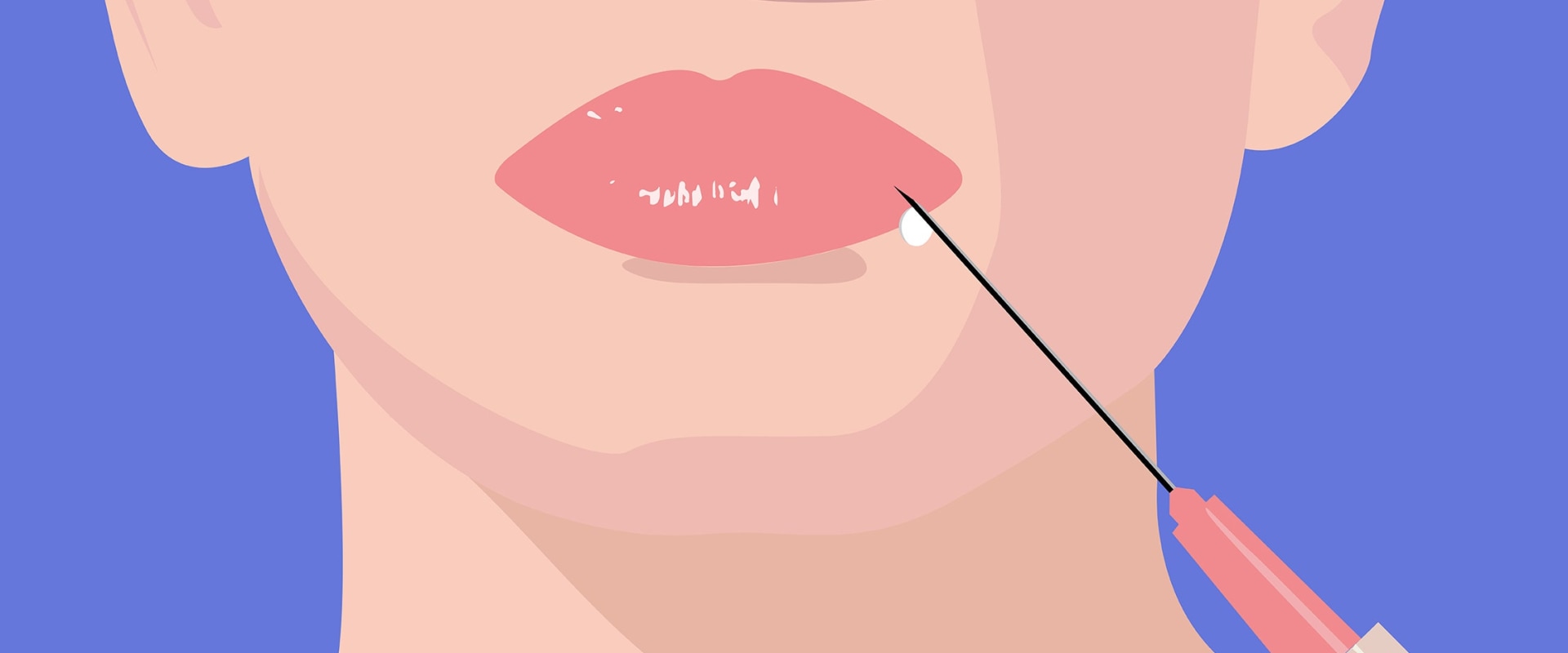 Where Does the Filling Go on Your Face? A Comprehensive Guide to Dermal Fillers