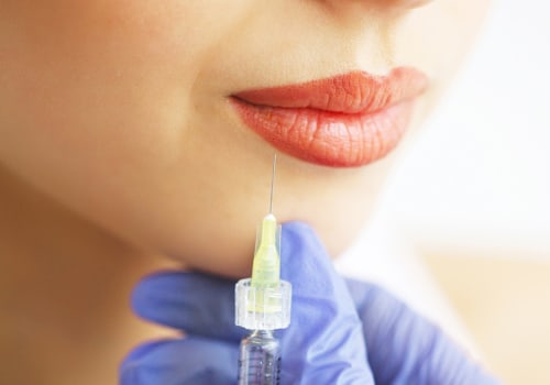 Do Filler Injections Hurt? An Expert's Perspective