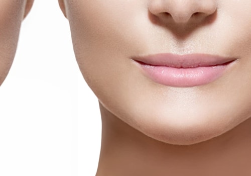 How Long Do Dermal Fillers Last?