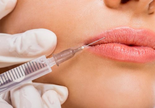 Whats Injectable Filler