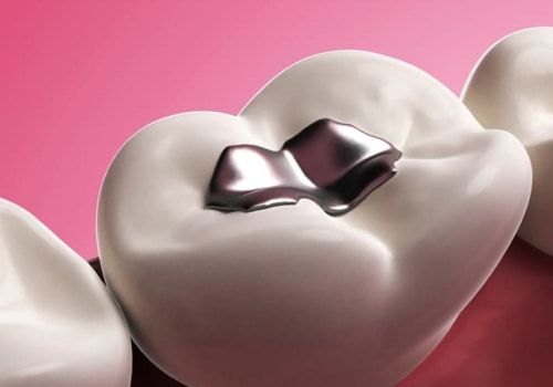 Dissolving Lip Fillers: How Does It Work?