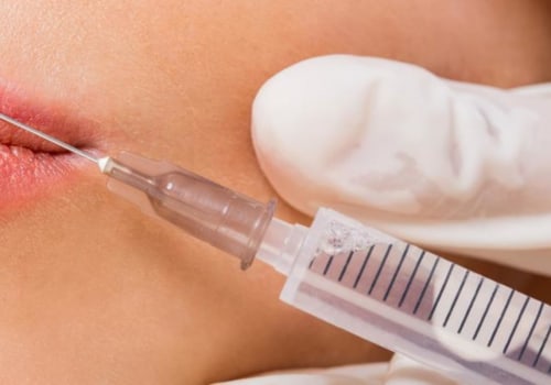 What is Injectable Filler Treatment? A Comprehensive Guide