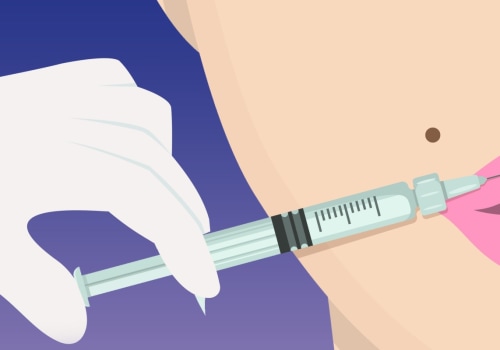 Where is the Filler Injected? A Comprehensive Guide to Dermal Fillers